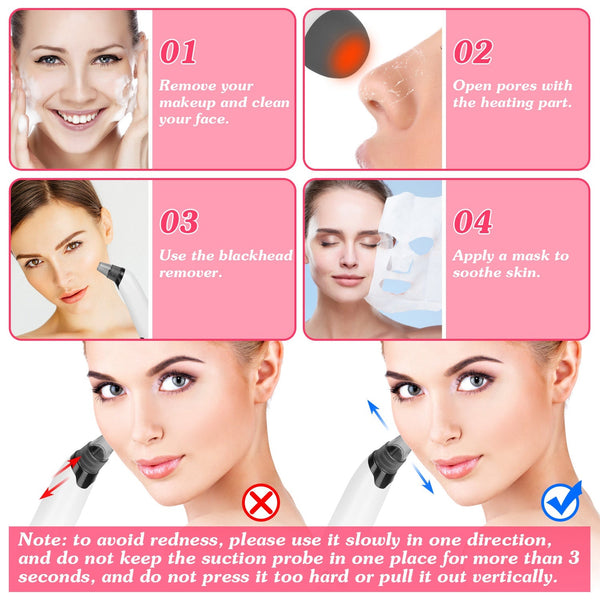 Hot Compress Blackhead Remover